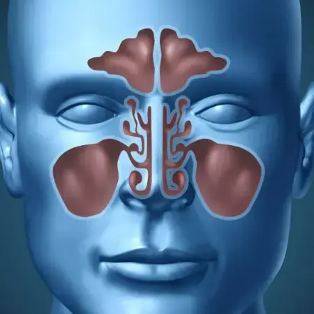 Allergy Rhinitis | Dhanani's ENT Clinic